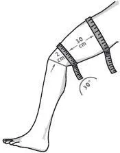 Bauerfeind MyoTrain Oberschenkelbandage – Bild 3